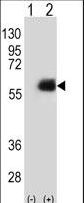 Western blot of NMT2 (arrow) using rabbit polyclonal NMT2 Antibody (E31). 293 cell lysates (2 ug/lane) either nontransfected (Lane 1) or transiently transfected (Lane 2) with the NMT2 gene.