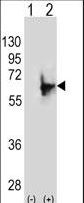Western blot of NMT2 (arrow) using rabbit polyclonal NMT2 Antibody (E31). 293 cell lysates (2 ug/lane) either nontransfected (Lane 1) or transiently transfected (Lane 2) with the NMT2 gene.