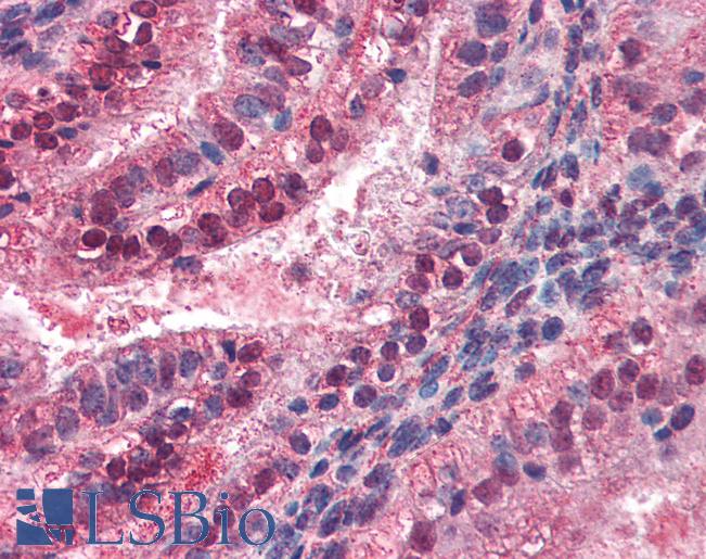 Anti-MED23 / DRIP130 antibody IHC of human uterus. Immunohistochemistry of formalin-fixed, paraffin-embedded tissue after heat-induced antigen retrieval. Antibody LS-B3039 dilution 1:100.