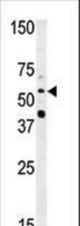 Western blot of anti-NMT2 antibody in HepG2 cell line lysate (35 ug/lane). NMT2(arrow) was detected using the purified antibody.
