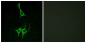 Immunofluorescence of LOVO cells, using NMUR1 Antibody. The picture on the right is treated with the synthesized peptide.