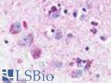 Anti-NMUR1 antibody LS-A397 IHC of human brain, neurons and glia. Immunohistochemistry of formalin-fixed, paraffin-embedded tissue after heat-induced antigen retrieval.