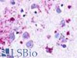 Anti-NMUR1 antibody LS-A396 IHC of human brain, neurons and glia. Immunohistochemistry of formalin-fixed, paraffin-embedded tissue after heat-induced antigen retrieval.