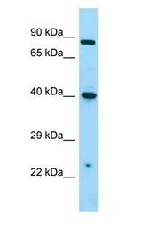 NMUR1 antibody Western Blot of A549 cell lysate. NMUR1 is supported by BioGPS gene expression data to be expressed in A549.
