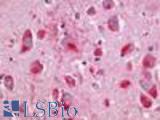 Anti-NMUR2 antibody LS-A423 IHC of human brain, neurons and glia. Immunohistochemistry of formalin-fixed, paraffin-embedded tissue after heat-induced antigen retrieval.