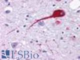 Anti-NMUR2 antibody LS-A422 IHC of human brain, neurons and glia. Immunohistochemistry of formalin-fixed, paraffin-embedded tissue after heat-induced antigen retrieval.