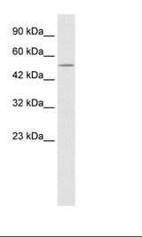 Jurkat Cell Lysate
