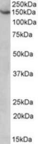 AGTPBP1 antibody (1 ug/ml) staining of HeLa lysate (35 ug protein/ml in RIPA buffer). Primary incubation was 1 hour. Detected by chemiluminescence.