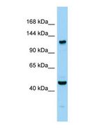 Western blot of Agtpbp1 Antibody - C-terminal region in Mouse Testis cells lysate.