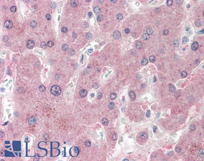 Anti-NNMT antibody IHC staining of human liver. Immunohistochemistry of formalin-fixed, paraffin-embedded tissue after heat-induced antigen retrieval. Antibody LS-B11469 concentration 20 ug/ml.
