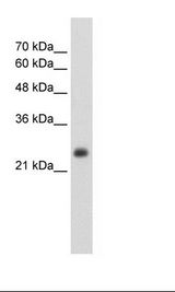HepG2 Cell Lysate