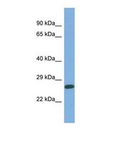Western blot of Human OVCAR-3. MED25 antibody dilution 1.0 ug/ml.