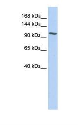 Fetal liver lysate. Antibody concentration: 1.0 ug/ml. Gel concentration: 6-18%.