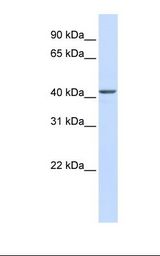 Fetal liver lysate. Antibody concentration: 1.0 ug/ml. Gel concentration: 12%.