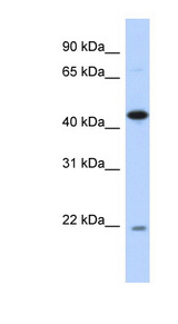 NOB1 antibody LS-C102576 Western blot of Transfected 293T cell lysate.