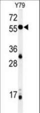 Western blot of NOB1 Antibody in Y79 cell line lysates (35 ug/lane). NOB1 (arrow) was detected using the purified antibody.