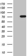 HEK293T cells were transfected with the pCMV6-ENTRY control (Left lane) or pCMV6-ENTRY NOBOX (Right lane) cDNA for 48 hrs and lysed. Equivalent amounts of cell lysates (5 ug per lane) were separated by SDS-PAGE and immunoblotted with anti-NOBOX (1:2000).
