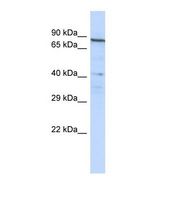 Western blot of Human Jurkat. NOBOX antibody dilution 1.0 ug/ml.