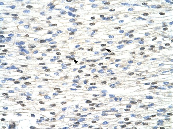 NOBOX antibody LS-C30391 was used in IHC to stain formalin-fixed, paraffin-embedded human heart.