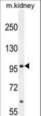 MED25 Antibody western blot of mouse kidney tissue lysates (35 ug/lane). The MED25 antibody detected the MED25 protein (arrow).