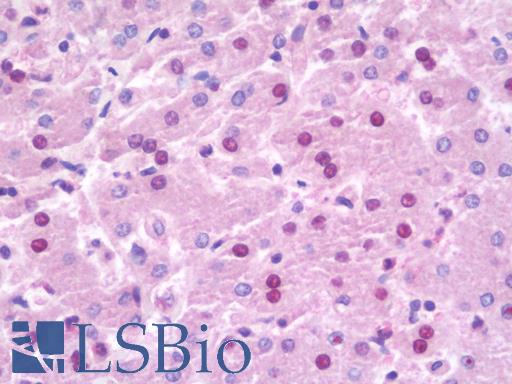 Anti-NOC3L antibody IHC staining of human liver. Immunohistochemistry of formalin-fixed, paraffin-embedded tissue after heat-induced antigen retrieval. Antibody LS-B9853 concentration 20 ug/ml.