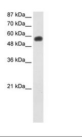 Jurkat Cell Lysate