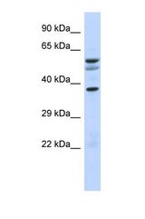 Western blot of Human Fetal Brain. NOC4L antibody dilution 1.0 ug/ml.