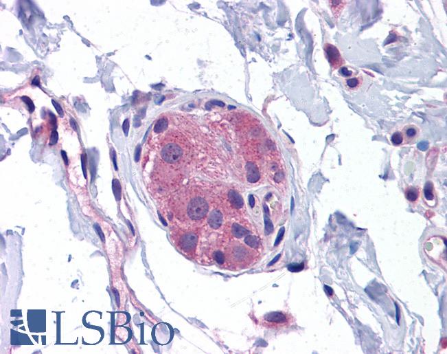 Anti-NOD1 antibody IHC of human small intestine, submucosal plexus. Immunohistochemistry of formalin-fixed, paraffin-embedded tissue after heat-induced antigen retrieval. Antibody LS-B5325 concentration 5 ug/ml.