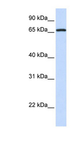 MED26 / CRSP7 antibody LS-C109826 Western blot of Fetal Brain lysate.