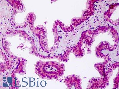 Anti-NOD1 antibody IHC staining of human prostate. Immunohistochemistry of formalin-fixed, paraffin-embedded tissue after heat-induced antigen retrieval.