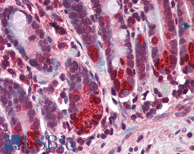 Anti-NOD2 antibody IHC of human small intestine. Immunohistochemistry of formalin-fixed, paraffin-embedded tissue after heat-induced antigen retrieval. Antibody LS-B2720 concentration 3 ug/ml.