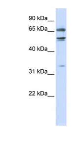 MED26 / CRSP7 antibody LS-C110282 Western blot of 293T cell lysate.