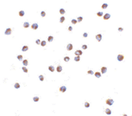 Immunocytochemistry of NOD2 in Jurkat cells with NOD2 antibody at 5 ug/ml.