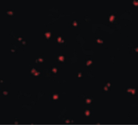 Immunofluorescence of NOD2 in Jurkat cells with NOD2 antibody at 20 ug/ml.