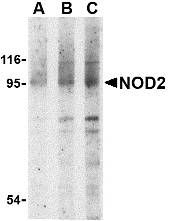 Western blot of NOD2 in Jurkat cell lysate with NOD2 antibody at (A) 1, (B) 2 and (C) 4 ug/ml.