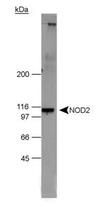 Detection of NOD2 in 20 ug of NOD2 transfected 293T cell lysate. ECL detection in 15 seconds.