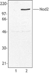 Cell extract from MCF-7 cells transfected with either human Nod1 (Lane 1) or human Nod2 (Lane 2) was resolved by electrophoresis, transferred to nitrocellulose, and probed with monoclonal anti-Nod2 antibody (clone NOD-15). Proteins were visualized using a