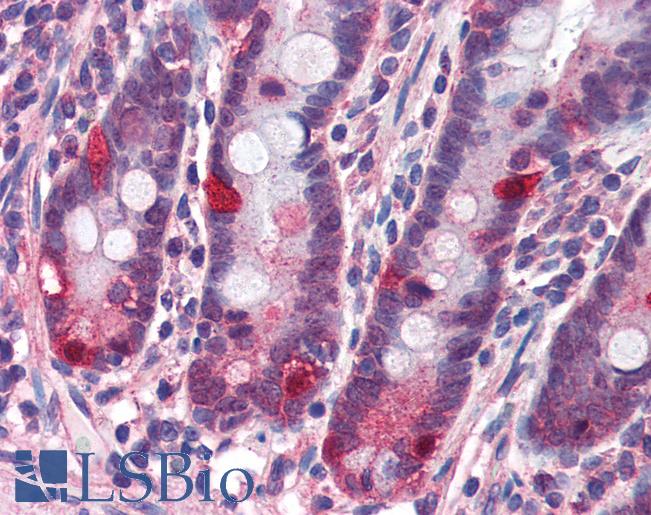 Anti-NOD2 antibody IHC of human small intestine. Immunohistochemistry of formalin-fixed, paraffin-embedded tissue after heat-induced antigen retrieval. Antibody LS-B2721 concentration 3 ug/ml.