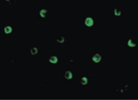 Immunofluorescence of NOD2 in HeLa cells with NOD2 antibody at 20 ug/ml.