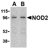 Western blot of NOD2 in HeLa cell lysate with NOD2 antibody at (A) 2 and (B) 4 ug/ml.
