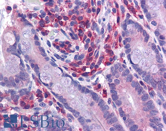 Anti-NLRC3 antibody IHC of human small intestine. Immunohistochemistry of formalin-fixed, paraffin-embedded tissue after heat-induced antigen retrieval. Antibody LS-B5326 concentration 5 ug/ml.