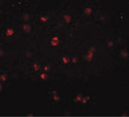Immunofluorescence of NOD3 in Jurkat cells with NOD3 antibody at 20 ug/ml.