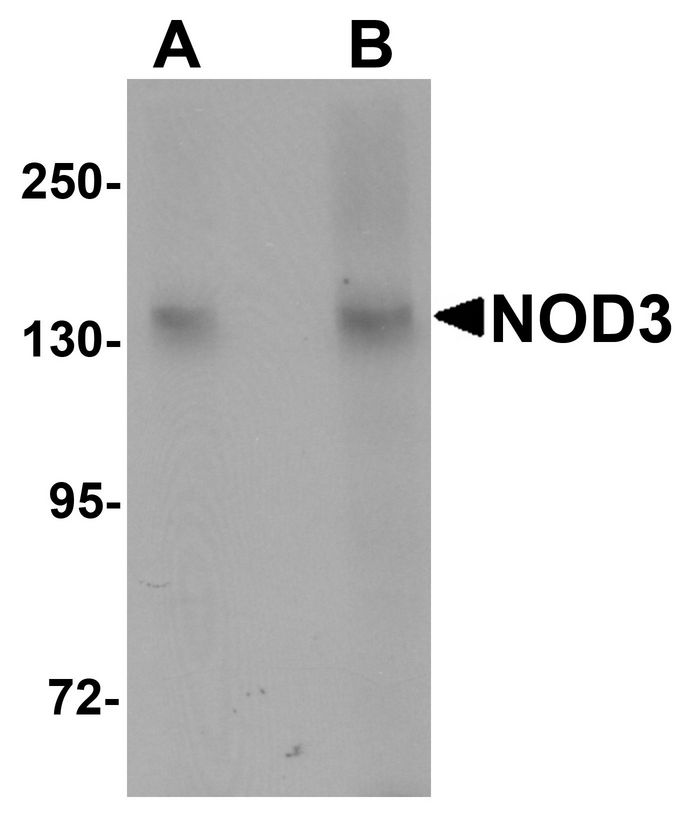 Western blot analysis of NOD3 in 3T3 cell lysate with NOD3 antibody at (A) 1 and (B) 2 ug/ml.