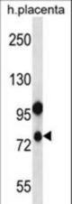 NLRP10 Antibody western blot of human placenta tissue lysates (35 ug/lane). The NLRP10 antibody detected the NLRP10 protein (arrow).