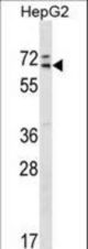 MED26 Antibody western blot of HepG2 cell line lysates (35 ug/lane). The MED26 antibody detected the MED26 protein (arrow).