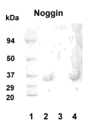 Western blot detection of Noggin in 20 ug of human hippocampus tissue lysate (lanes 2 and 4) with Noggin polyclonal at 1:1000 dilution followed by AP-conjugated secondary at 1:5000 dilution. MW marker lane 1. Peptide absorption control lane 3.