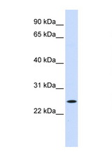 NOL3 antibody LS-C112317 Western blot of Fetal Muscle lysate. Antibody concentration 1 ug/ml.
