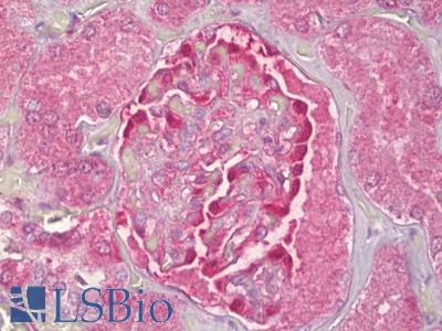Anti-NOL3 antibody IHC of human kidney, glomeruli. Immunohistochemistry of formalin-fixed, paraffin-embedded tissue after heat-induced antigen retrieval. Antibody LS-B7016 concentration 10 ug/ml.