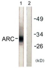 Western blot of extracts from HeLa cells, using ARC Antibody. The lane on the right is treated with the synthesized peptide.