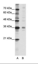 A: Marker, B: HepG2 Cell Lysate